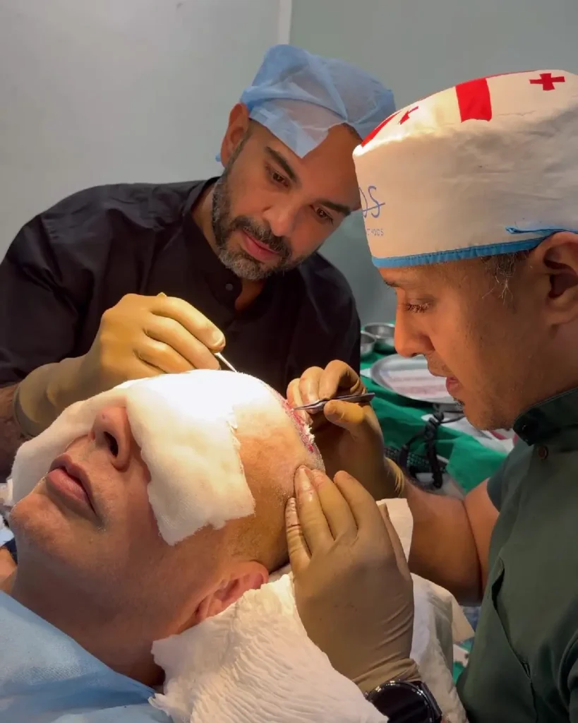 Dr. Deepam Shah Performing Hair Transplant Surgery