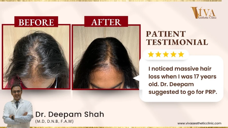 Female hair loss patient testimonial