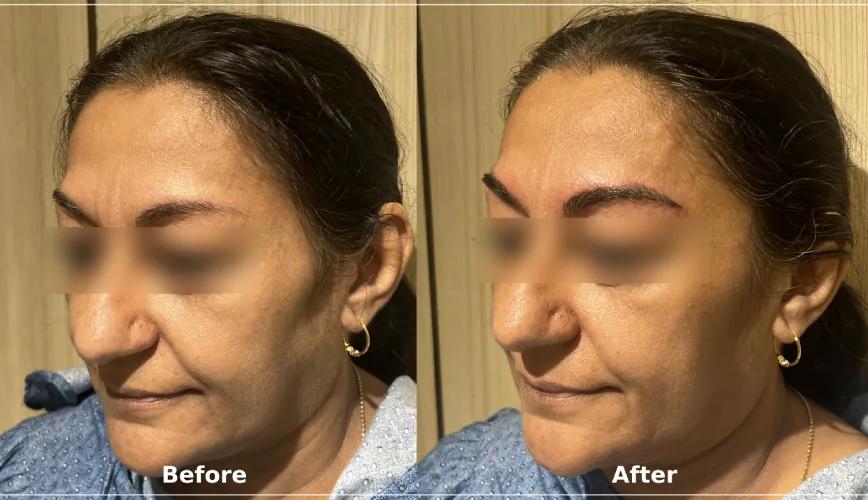 eye microblading before and after photo