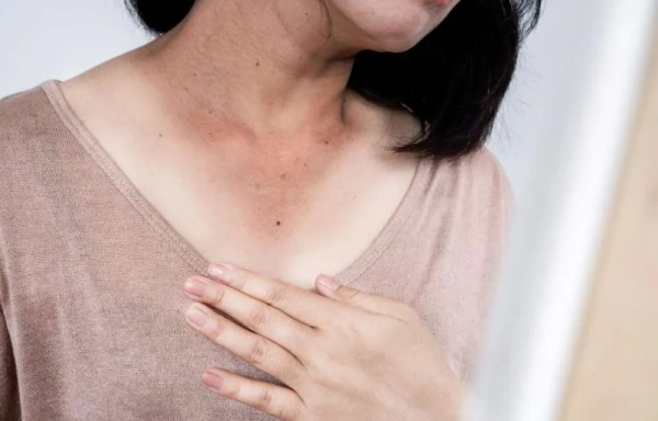 Dark Neck Pigmentation Treatment in Mumbai Viva Aesthetic Clinic Dark Neck Pigmentation Treatment in Mumbai