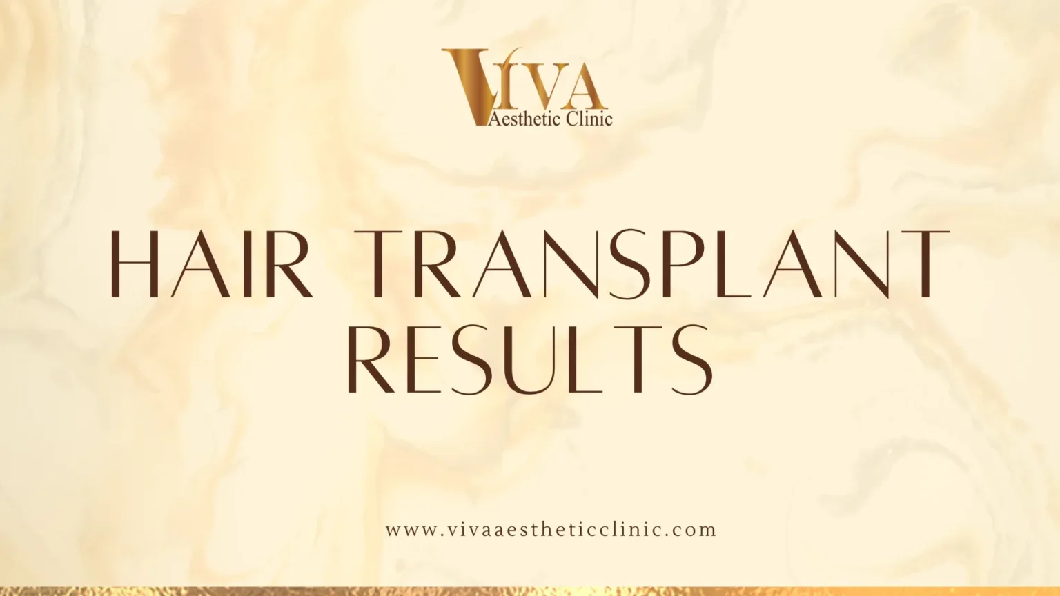 Hair Transplant Result