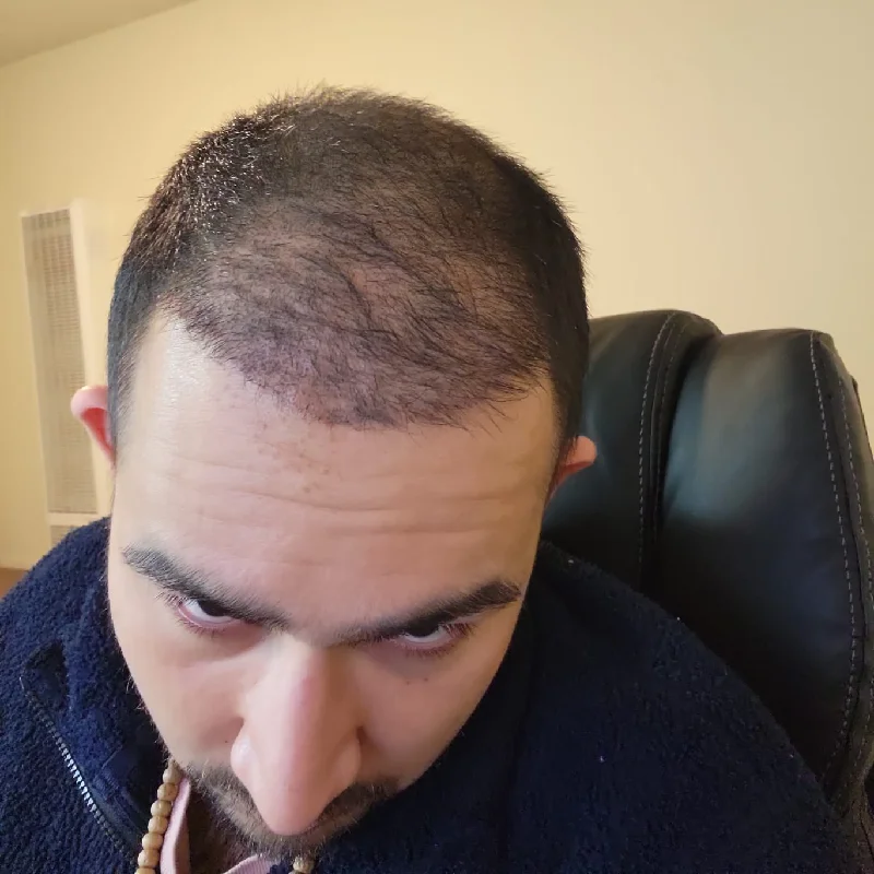 3 Months