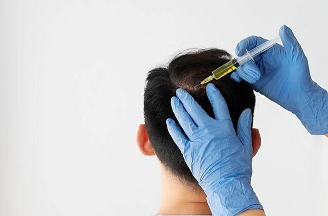 GFC Hair Treatment Success Rate in Mumbai
